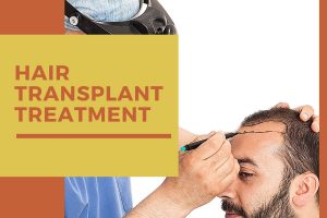 How to treat Hair Loss with a Hair Transplant Treatment for People over 50