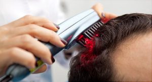 Non-surgical hair loss treatment