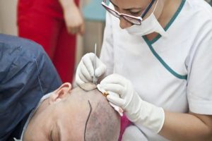 Surgical hair restoration treatment